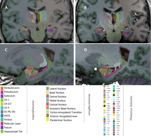 Bestimmung von Volumina des Hippocampus und Thalamus mittels FreeSurfer